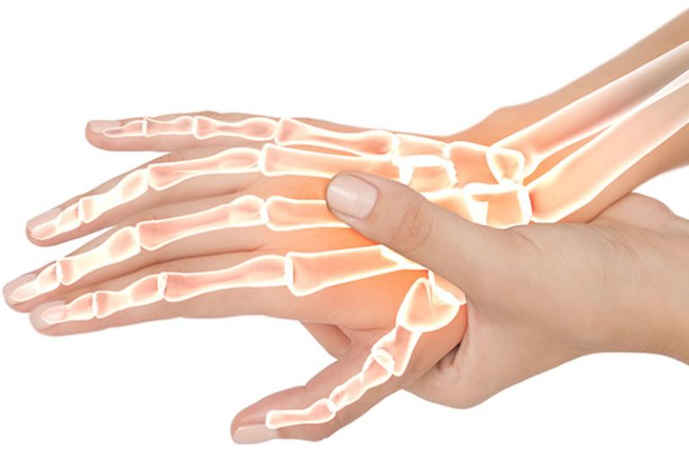 Locking Finger Joints and Trigger Finger Arthritis HealthRemedy123